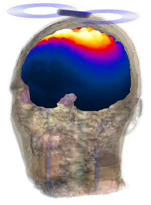 cervello